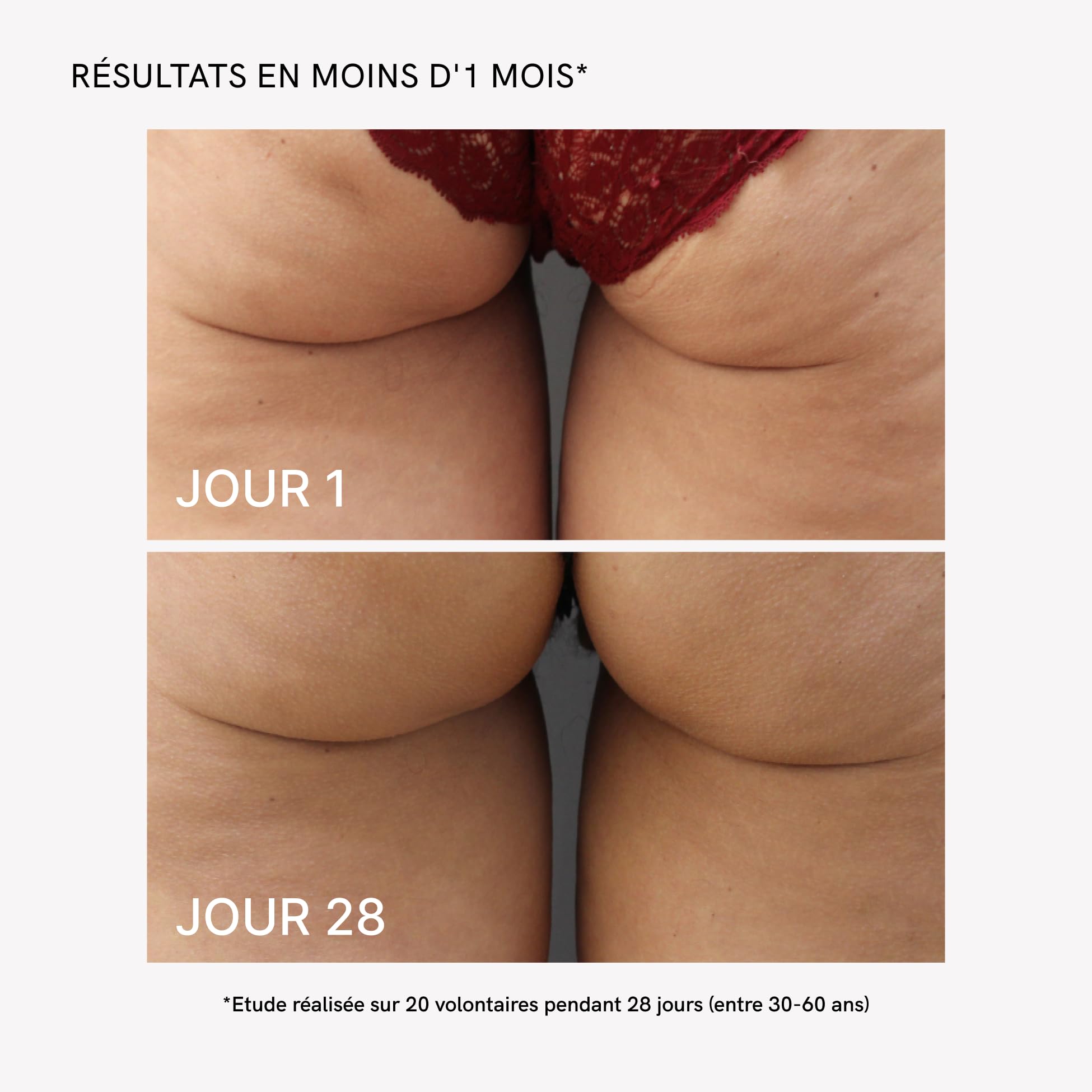 MASDERM - Cellulite 2-en-1, Appareil Radiofréquence Corporelle Professionnel avec Crème Anti-Cellulite Raffermissante 500 ml et Technologie EMS LED, Traitement Réducteur et Anti-Graisse - Pack de 2