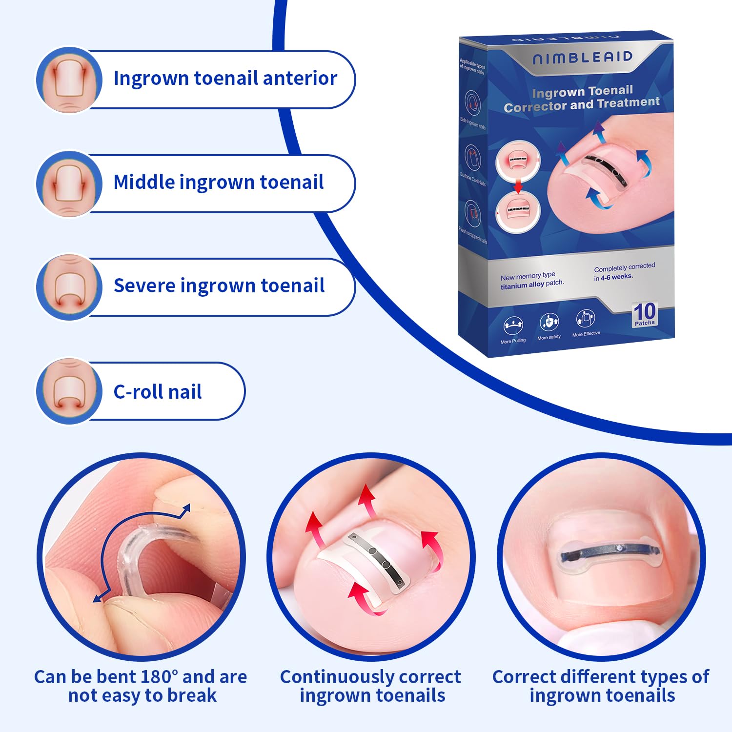 Titanium Alloy Ingrown Toenail Treatment & Corrector Kit - 3 Sizes Corrector for Men & Women Various Nail Sizes & Foot Types,Ingrown Toenail Removal Tool (10 Count-Large Size)