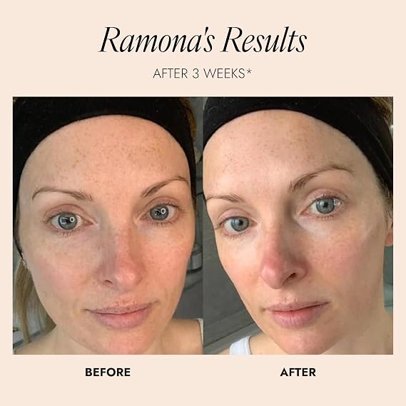 SKINICIAN Advanced Pro-Radiance Enzyme Peel - Peel Off Face Mask for Brighter Looking Skin - AHA Beauty Facial Mask - Anti-Ageing Fruit Enzyme Peel - Vegan & Cruelty Free (50ml) | AHA fruit enzyme peel-off mask. Anti-ageing formula for brighter radiant looking skin. Vegan.