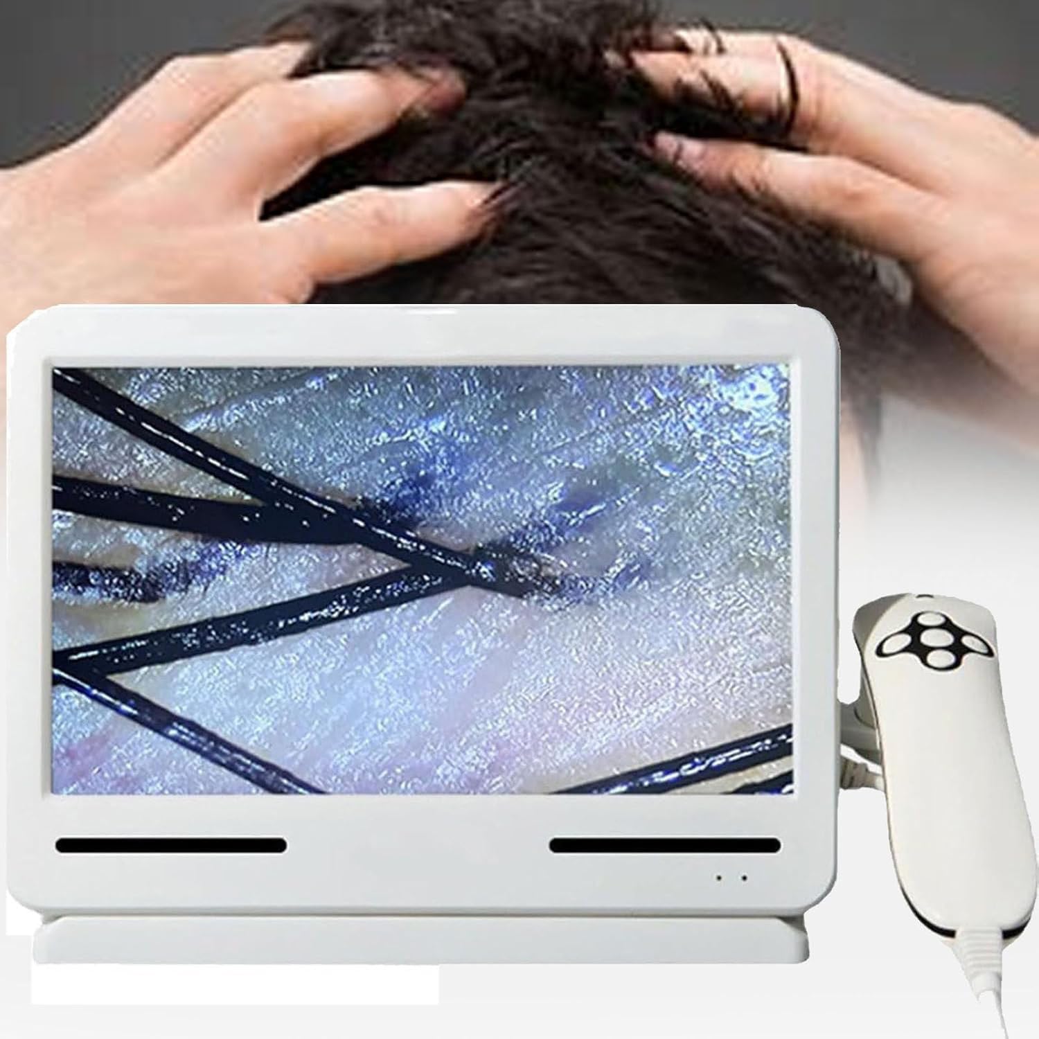 Hautdiagnose-Haaranalysator, 10,1-Zoll-Haut-Kopfhaut-Detektor, Multifunktionales Haarfollikel-Analysegerät, Haut-Kopfhaut-Detektor, Haaranalyse-Scanner