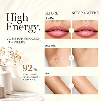 IPL Laser Hair Removal Device for Women and Men At Home Permanent Painless Lazer Hair Remover depiladora laser para mujer Long Lasting Results for Face Body Bikini Line Armpits Legs