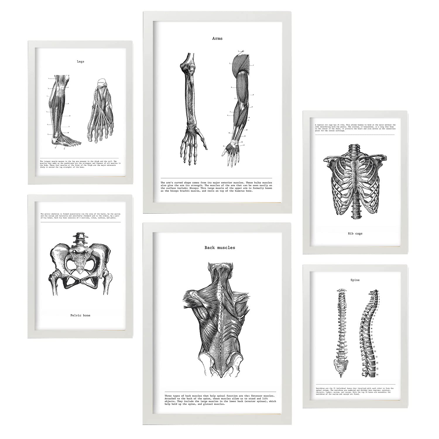 Nacnic – Set of 6 Body anatomy frames (back, leg, arm, spine, pelvis, ribs). Posters ideal for clinics. Sizes A3 and A4, with white frame.