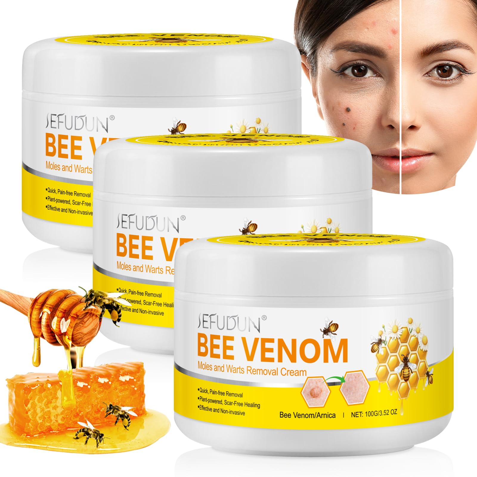 Bienengift Creme 100ml, Bienengiftsalbe Natürliche Bienengift Gegen Warzen Creme, Bee Venom Cream Bienengift Warzen und Etikettenentferner für Arm Taille Füße Bein Alle Hauttypen, 2PC