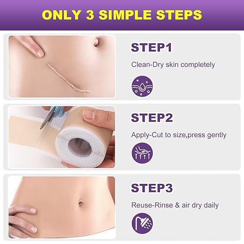 Miniatura 5 de Hojas de silicona para cicatrices, cinta de silicona para cicatrices (rollo de 1.6 x 120 pulgadas, 9.8 ft), cinta de cicatriz para eliminación de