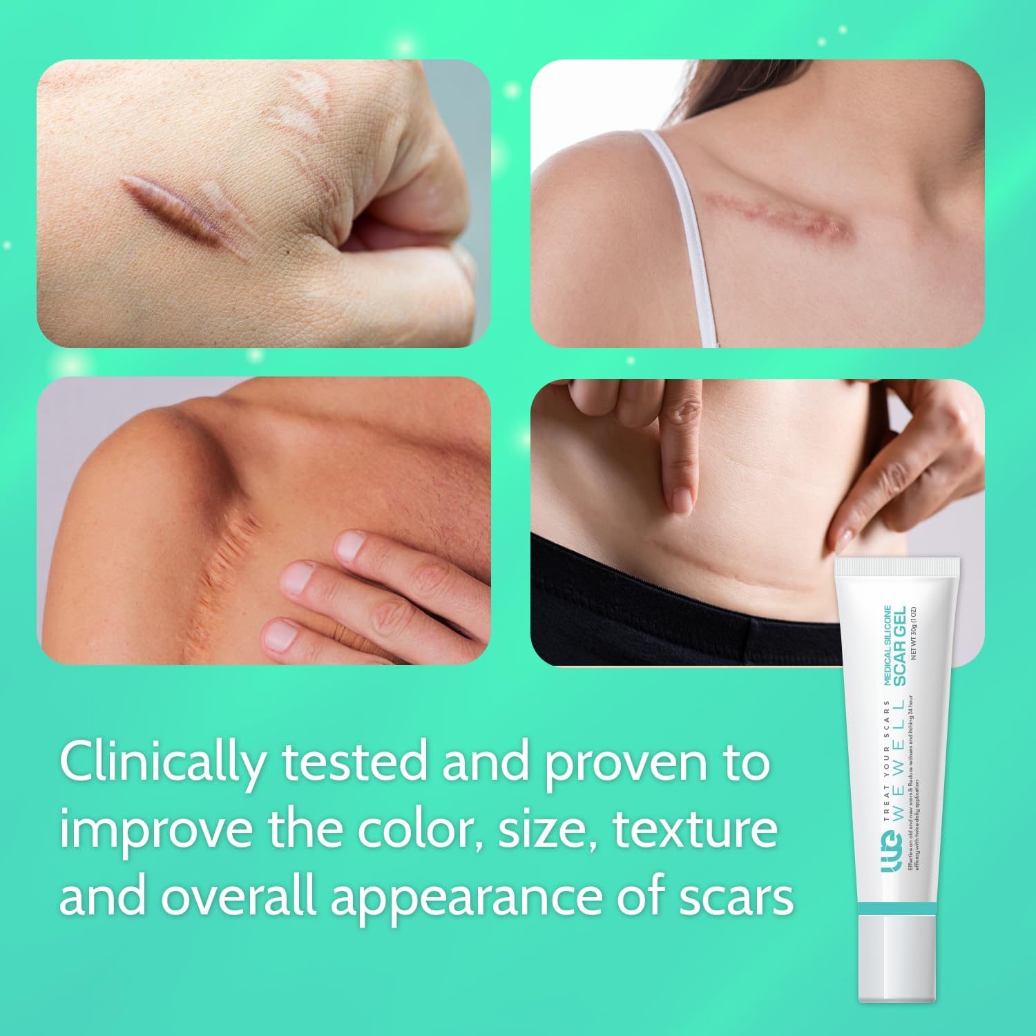 Scar Cream Keloid Bump Removal: Advanced Silicone Scar Gel – Smooth & Soothe the Look of Scars, Stretch Marks, and Skin Blemishes – 1 oz - Image 3