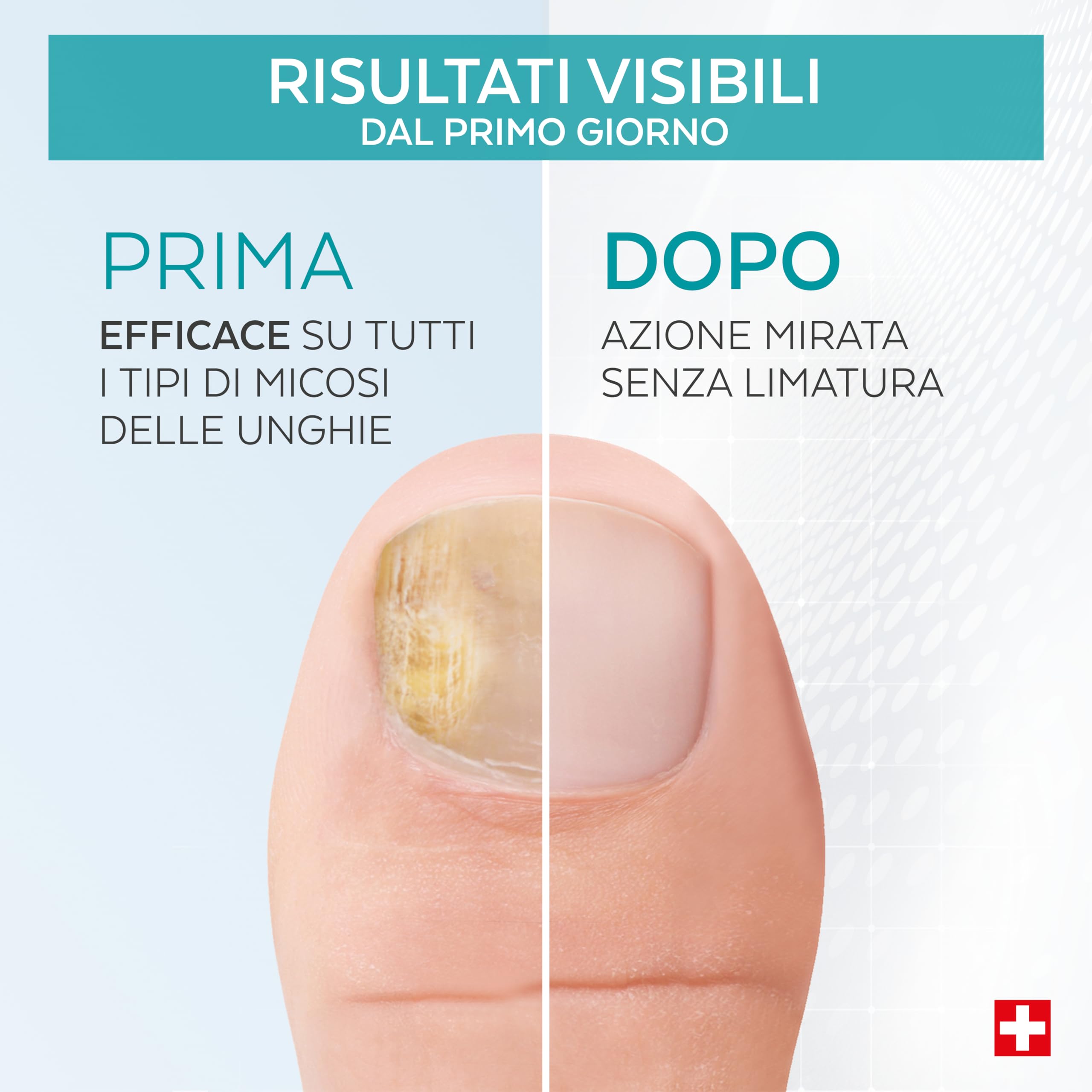 PODERM - TRATTAMENTO MICOSI UNGHIE | Soluzione Naturale Unghie Fungus | Alle piante potenti,riparatrici, purificanti e rivitalizzanti | Trattamento mani/piedi |Facile & rapido| Prodotto in Svizzera