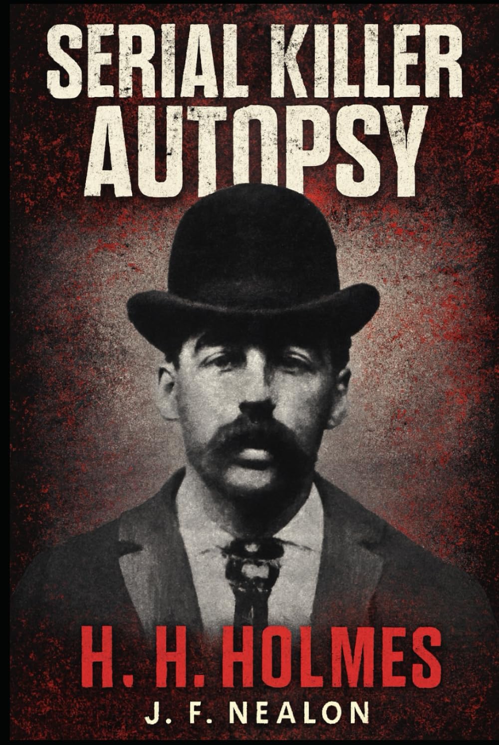 Serial Killer Autopsy: H. H. Holmes