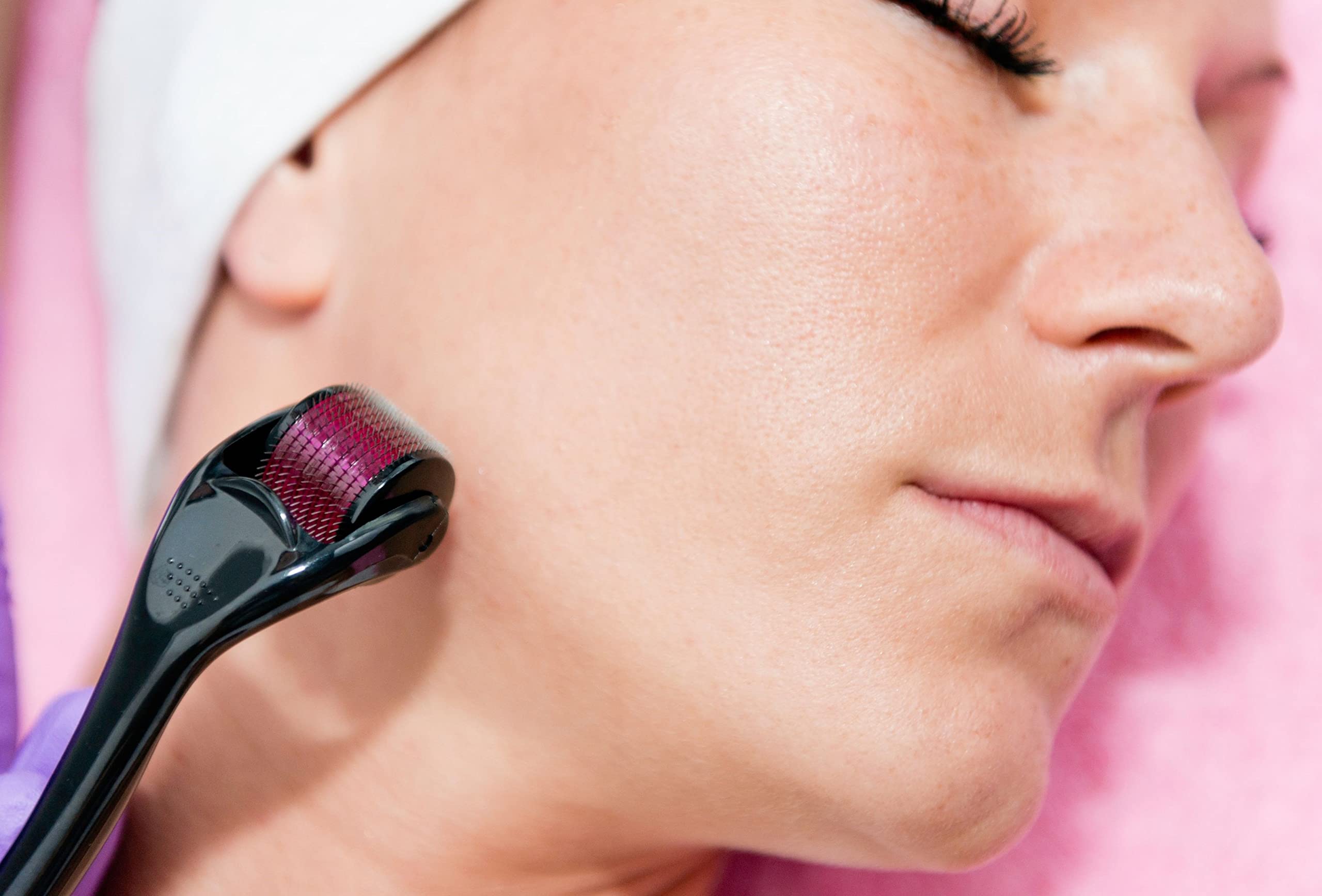 Dermaroller Viso Professionale con 540 Microaghi da 0.5 mm per Trattamento Rughe Cellulite Smagliature Acne Crescita Capelli e Barba