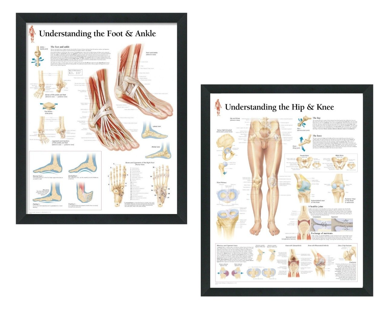 Buy Set of 2 Framed Medical s Understanding the Hip and Knee and ...