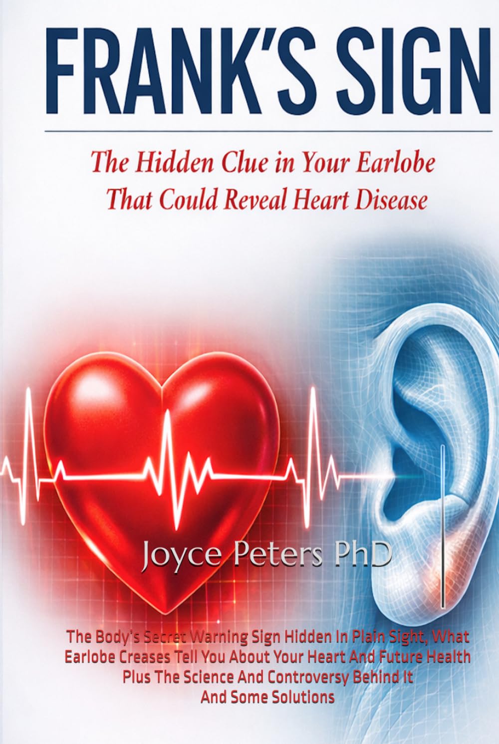 Frank's Sign: The Body’s Secret Warning Sign Hidden In Plain Sight, What Earlobe Creases Tell You About Your Heart And Future Health Plus The Science And Controversy Behind It And Some Solutions