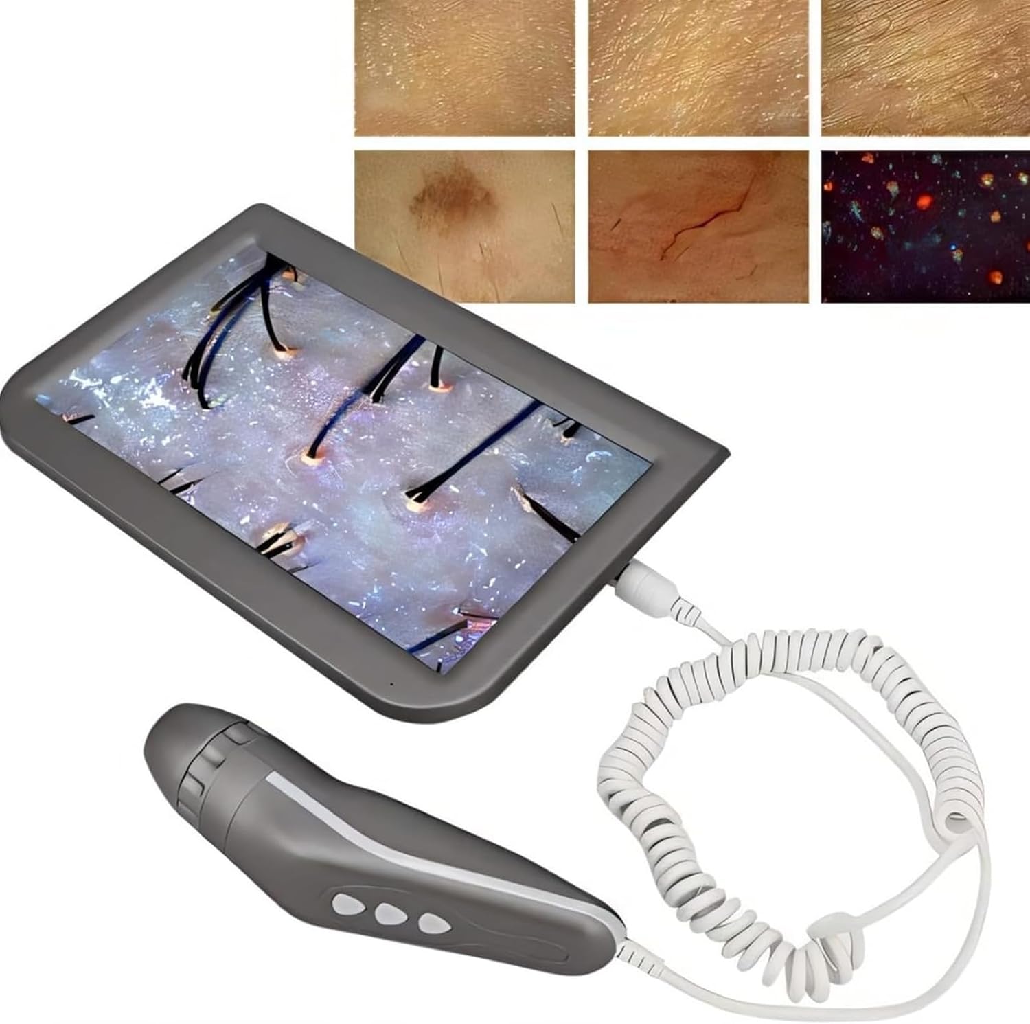 10.1 LCD Skin & Hair Analyzer - Digital Scalp, Follicle & Skin Detection Tool, Rechargeable Diagnostic Instrument for Professional & Home Use