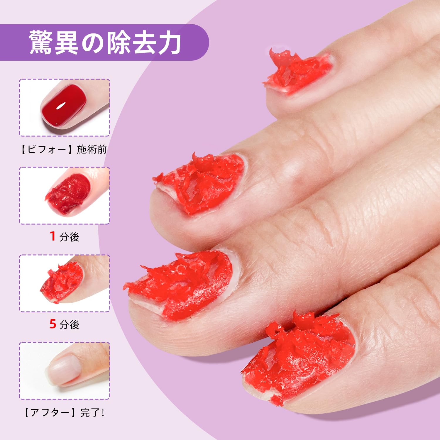 Amazon | JODSONE 18ml ジェルネイルリムーバー、ジェルネイル除去剤