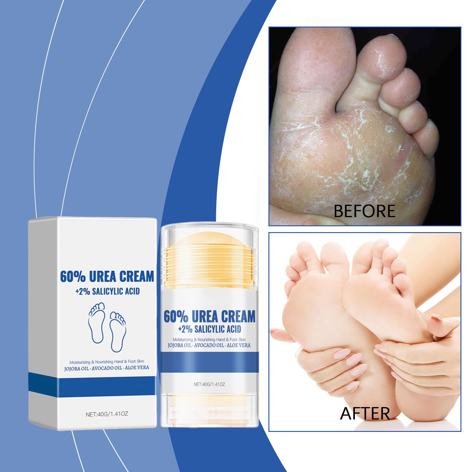 60% ige Urea-Fußcreme, feuchtigkeitsspendende Fersenpflege (6pcs)