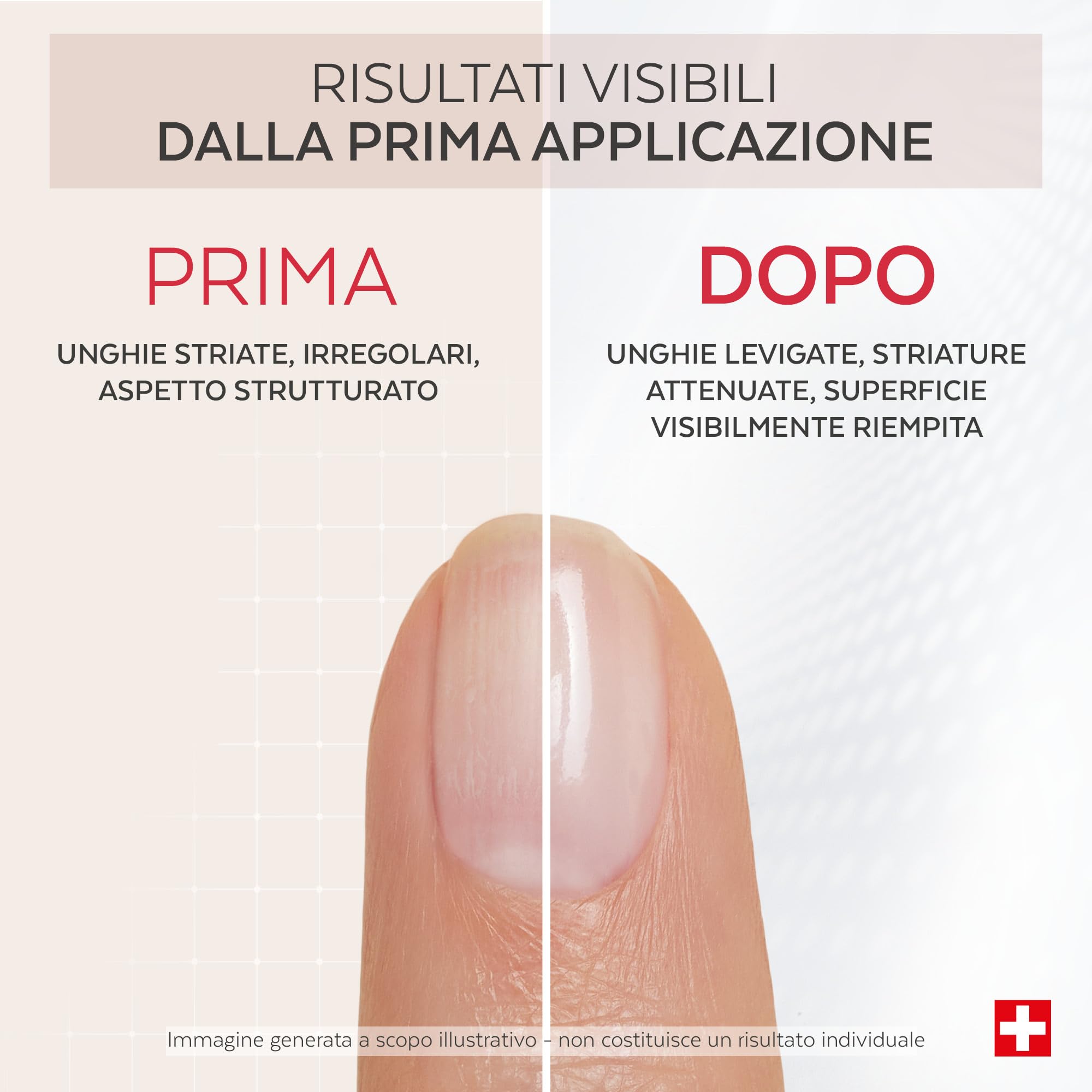 PODERM Smalto Trattamento Correttore & Perfezionatore – Collagene | Leviga, Attenua e Riempie Striature con Finish Gel Naturale – 8ml | Unghia Protetta Uniforme | Sviluppato da un Podologo in Svizzera