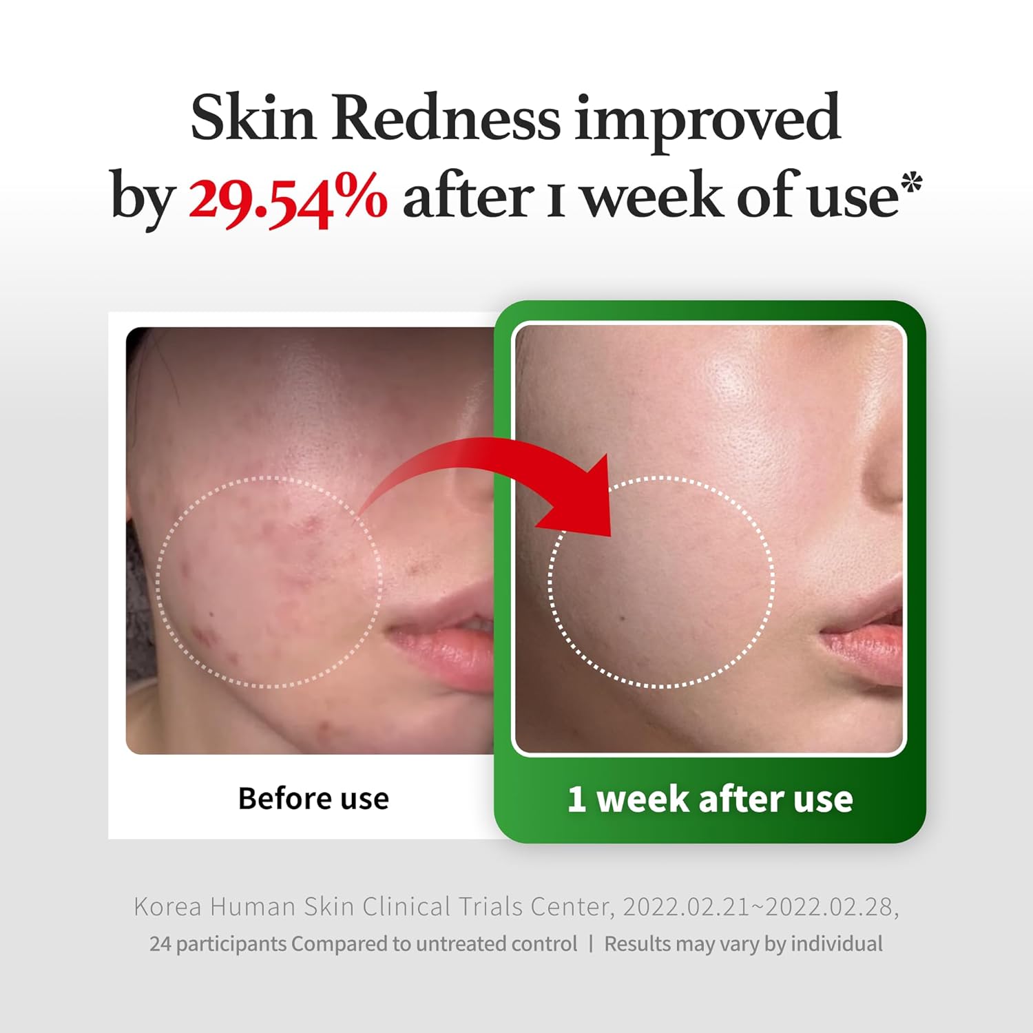 Peptide Derma Relief Cream – EGF, CICA & Panthenol Barrier Support Face Moisturizer, Korean Skincare for Sensitive Skin, Soothing & Calming Irritated Skin, Unscented, 1.35 Fl Oz
