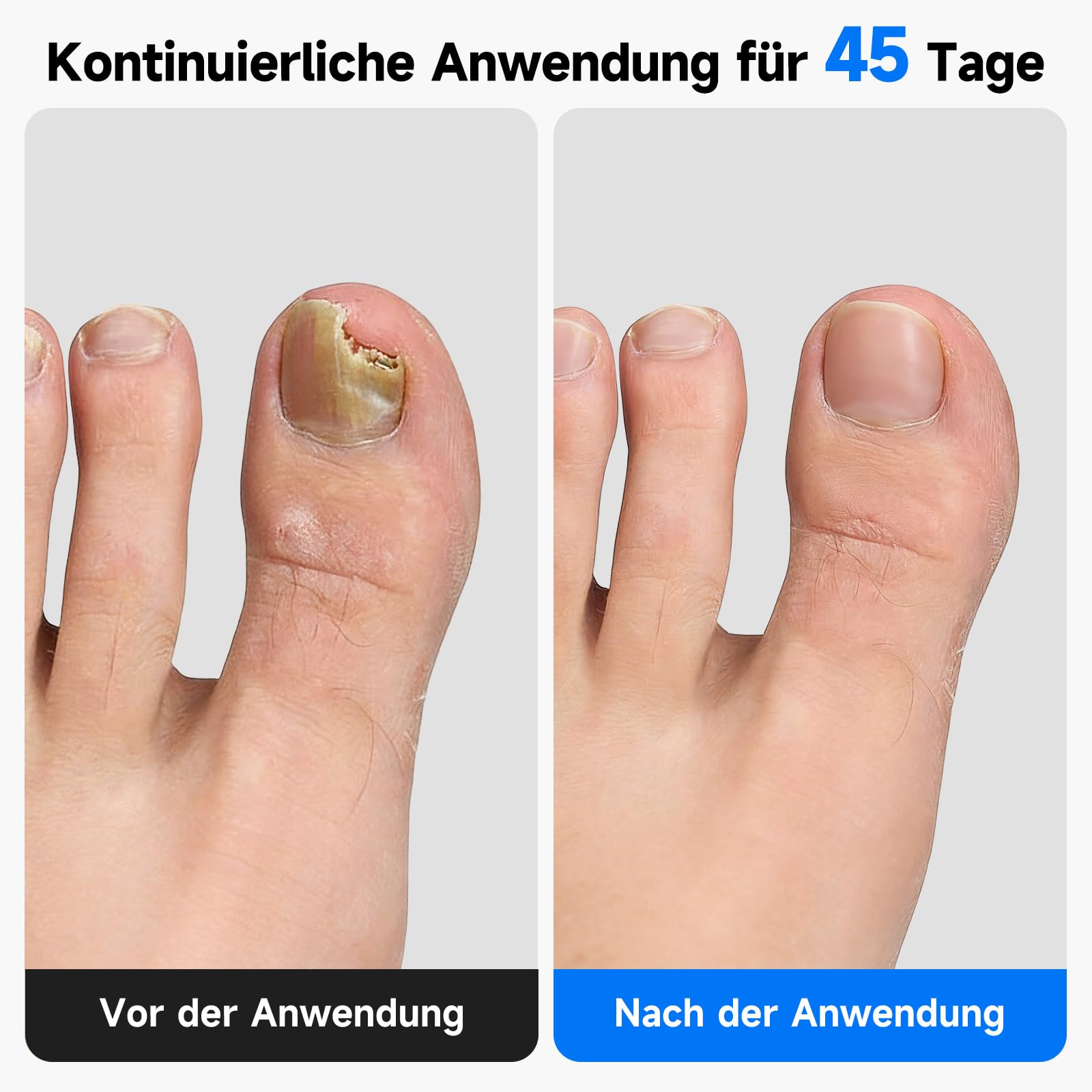 Nagelpflege Gerät für mehrere Zehennägel & Fingernägel, Nagelreinigungs und Pflegegerät mit timer