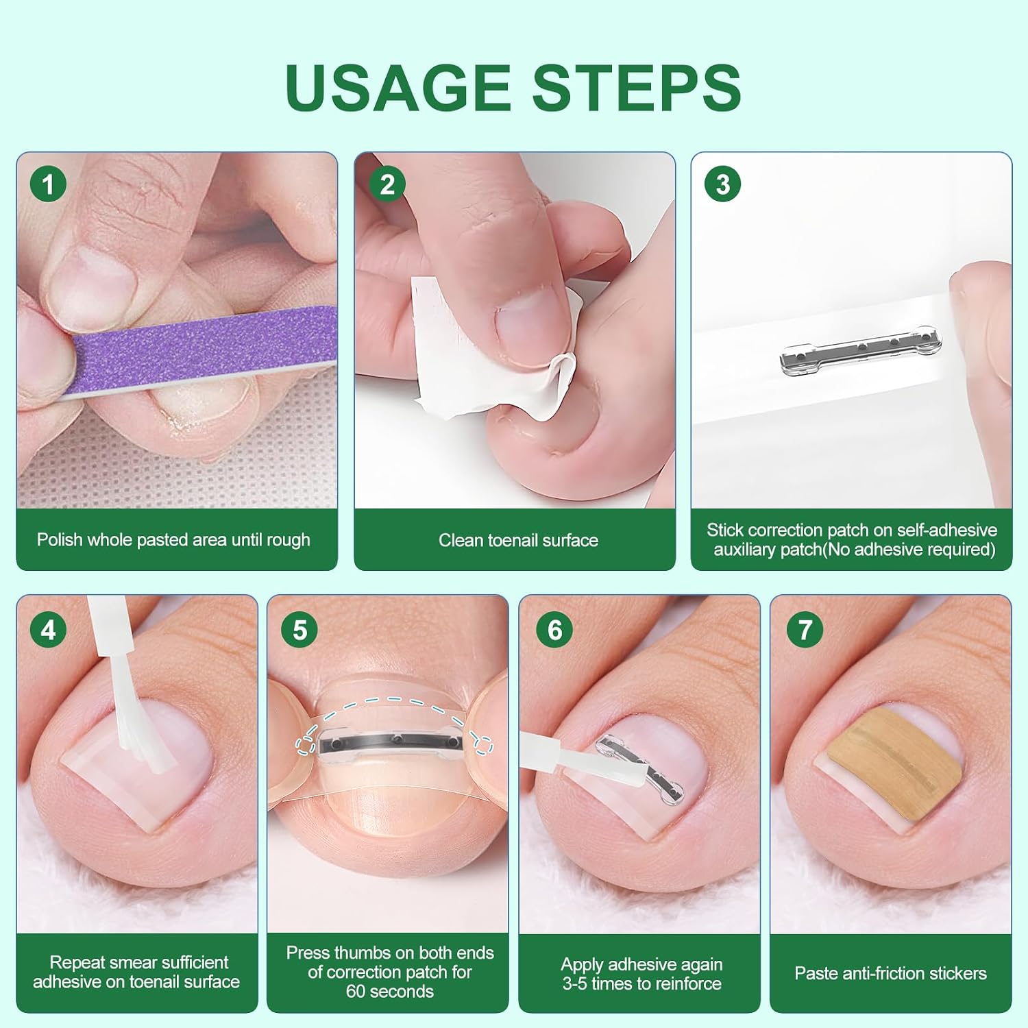 Ingrown Toenail Corrector Strips for Curved Toenail Quick Relief,4 Multi-Sizes Ingrown Toenail Treatment Removal Kit for Home Use,12Pcs