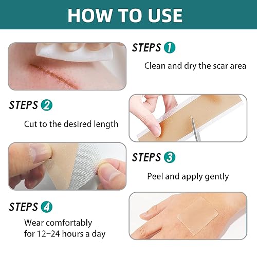 Miniatura 6 de Cinta de silicona para cicatrices quirúrgicas láminas de gel de cicatrices de grado médico para recuperación y tratamiento de abdominoplastia de