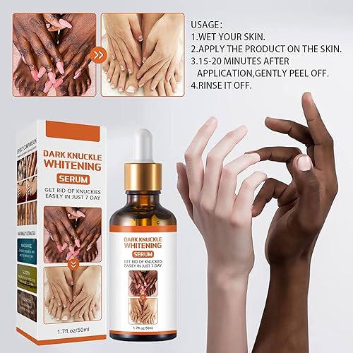 Miniatura 6 de Acanthosis Nigricans - Corrector de manchas oscuras para acantosis, manchas oscuras para aclarar la piel negra, suero iluminador de la piel, para