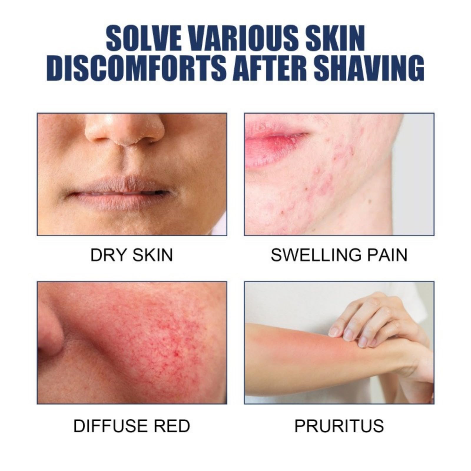 Body Hair Removal Spray, Easy off Foaming Natural Permanent Hair Removal Spray Smoothing Soluzione contro i peli incarni,Essence Riparatrice Dopobarba In Rollon,Lenisce la pelle secca e rossa