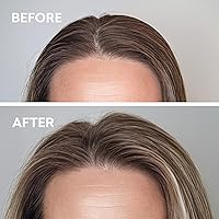 Vista 5 de Volumizer Hair Tonic Volumen instantáneo y levantamiento Tónico ligero para hombres y mujeres Levantador natural de raíces de cabello