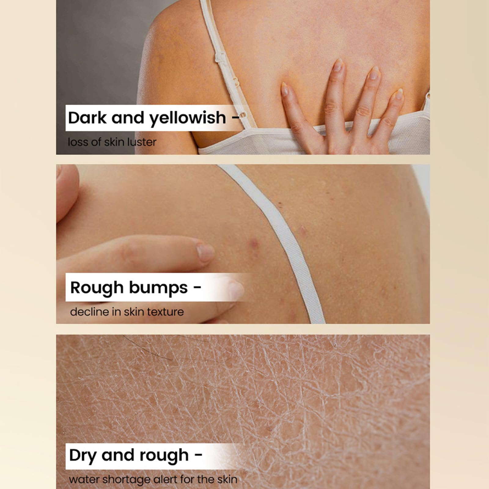 Stick esfoliante per il corpo all'acido glicolico, lozione esfoliante, leviga la pelle ruvida, riduce l'aspetto della cellulite, effetto pelle radiosa, stick per la cura del corpo per ascelle, gambe