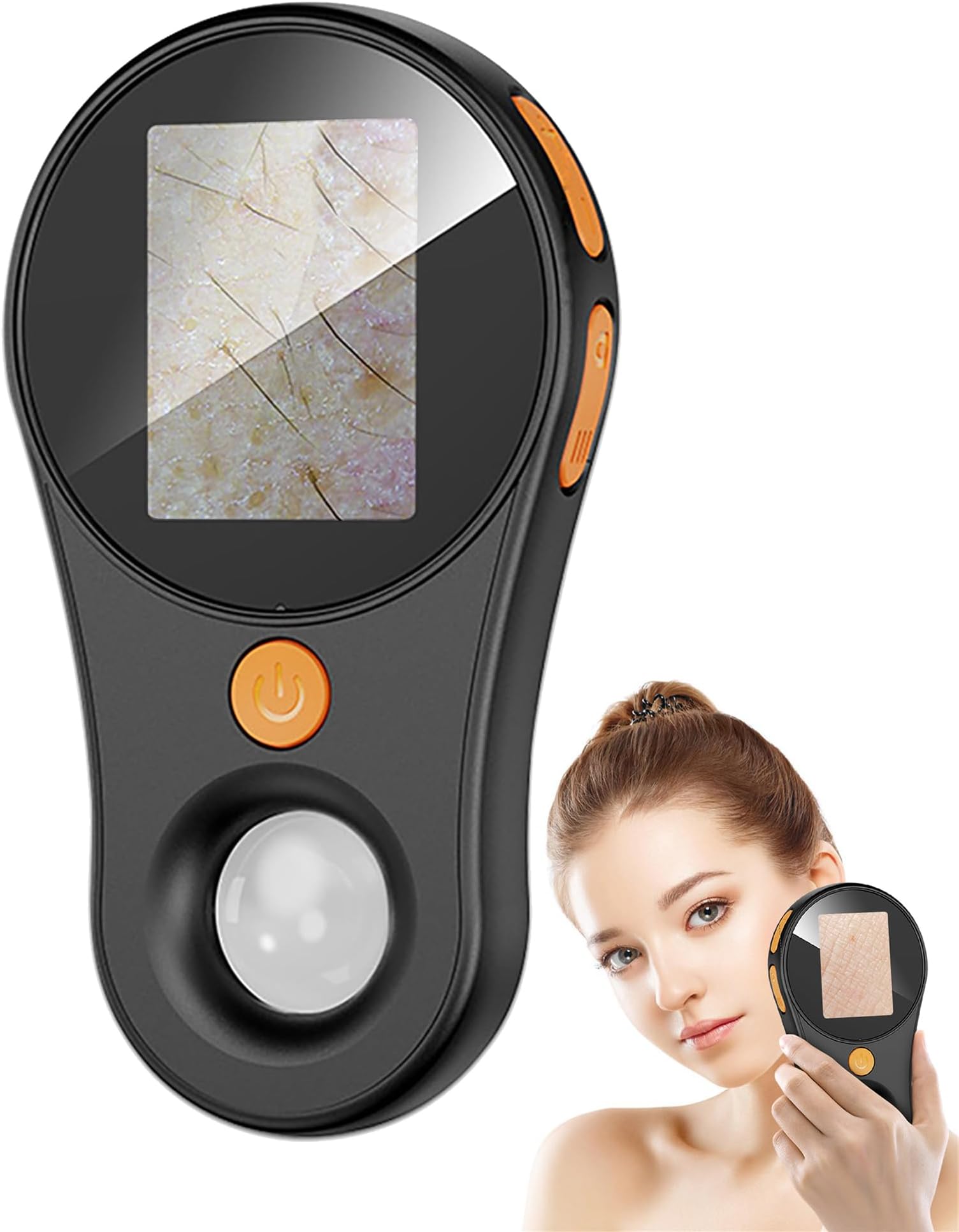 Dermatoscope Scalp Camera, Skin Analysis Machine, Handheld 2-in-1 Observer fo...