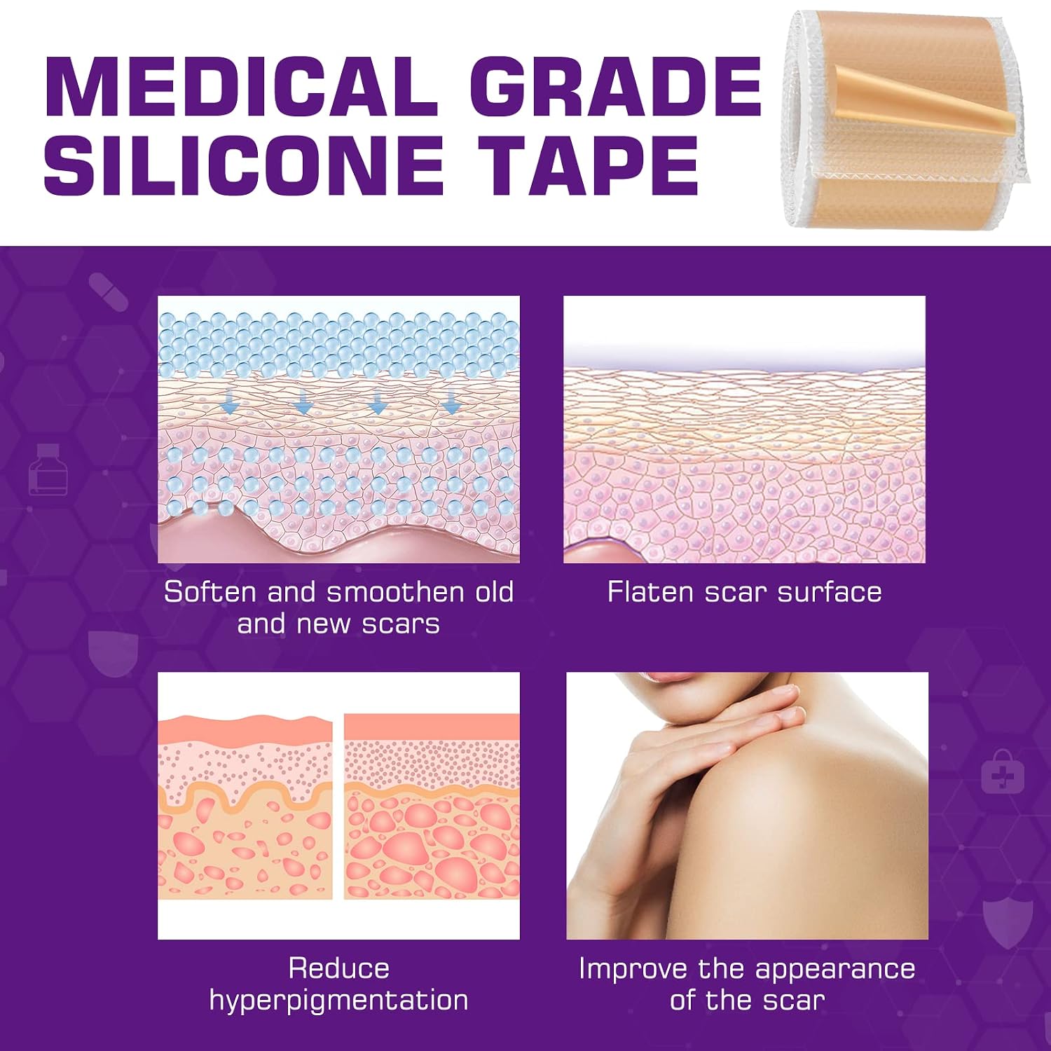 L minas de silicona para cicatrices rollo de 16 x 60 pulgadas 49ft de
