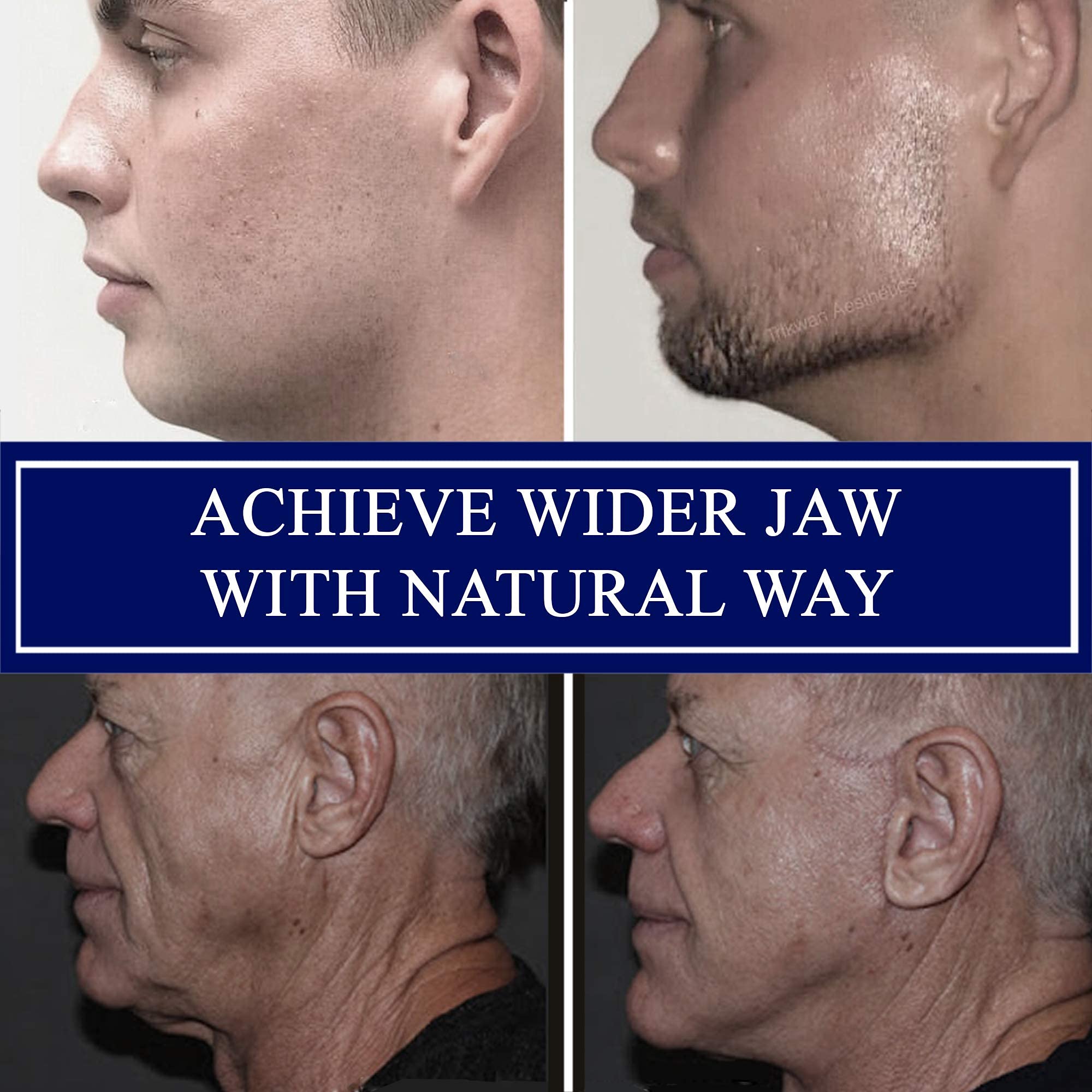 MrTee Chisel Your Jaw Exerciser, Jaw Exerciser For Women & Jawline