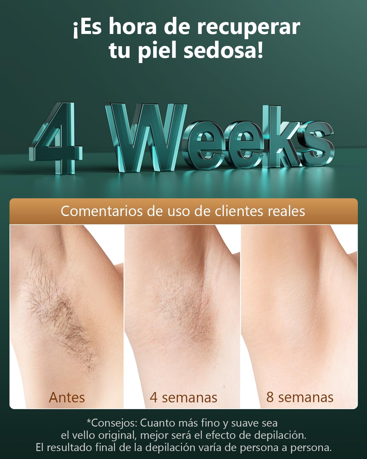 21J Depiladora Laser con Tecnología IGBT Fast Flash de 0,8s, Parpadeo Ilimitado Depiladora Luz Pulsada mujer de 600-1200NM, 3 Unique Modes Laser Depilacion Cara, Bikini, Cuerpo, Oro Verde