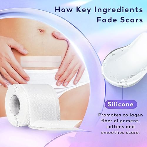 Miniatura 3 de Silicone Scar Sheets, Silicone Scar Tape(1.6"x 60" Roll-1.5M), Medical Grade Scar Sheets, Scar Tape for Surgical Scars, Burn, C-Section, Keloid