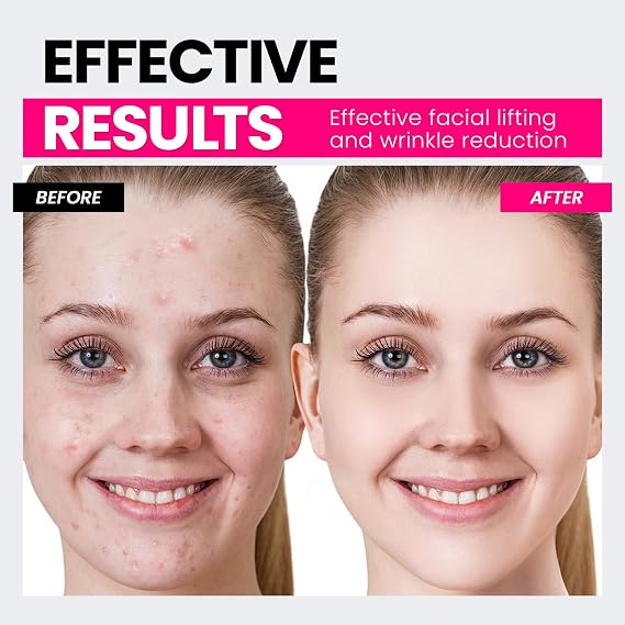 Hunvva Microcurrent Facial Device,Latest Red Light Technology,Enhances The Ability to Lift The Face and Tighten The Skin,Facial Wrinkle Equipment,Smart Photon Micro-Current Device,Model:EP-300.