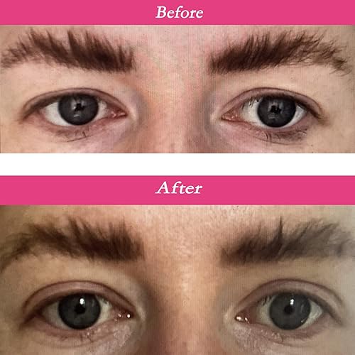 Miniatura 5 de 200 pares de calcomanías pequeñas naturales de doble párpado (adhesivo de una cara), tiras de elevación de párpados transpirables, párpados al