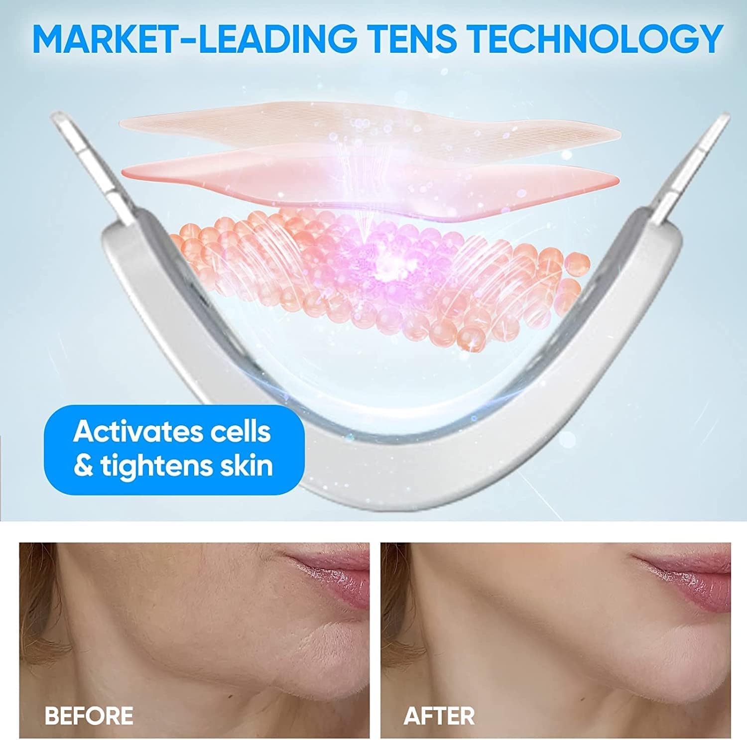 Double Chin Reducer Machine, V Line Face Lift Massager, Portable Shaping Facial Massager with Blue Light Improve Facial Contour and Skin