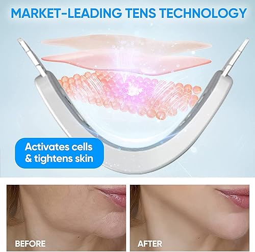 Miniatura 3 de Máquina reductora de mentón doble, masajeador facial de línea V, masajeador facial de moldeo portátil con luz azul para mejorar el contorno facial y