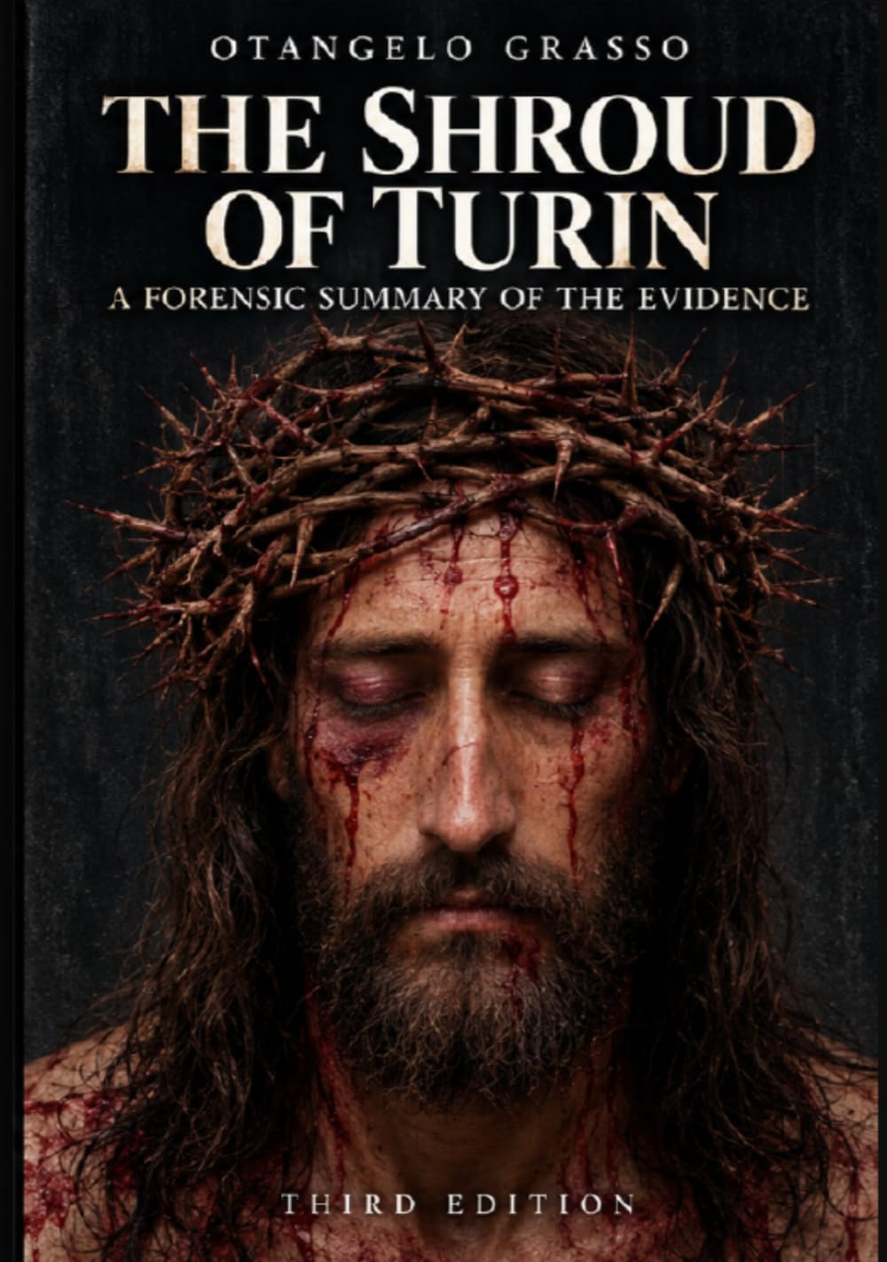The Shroud of Turin: A Forensic Summary of the Evidence