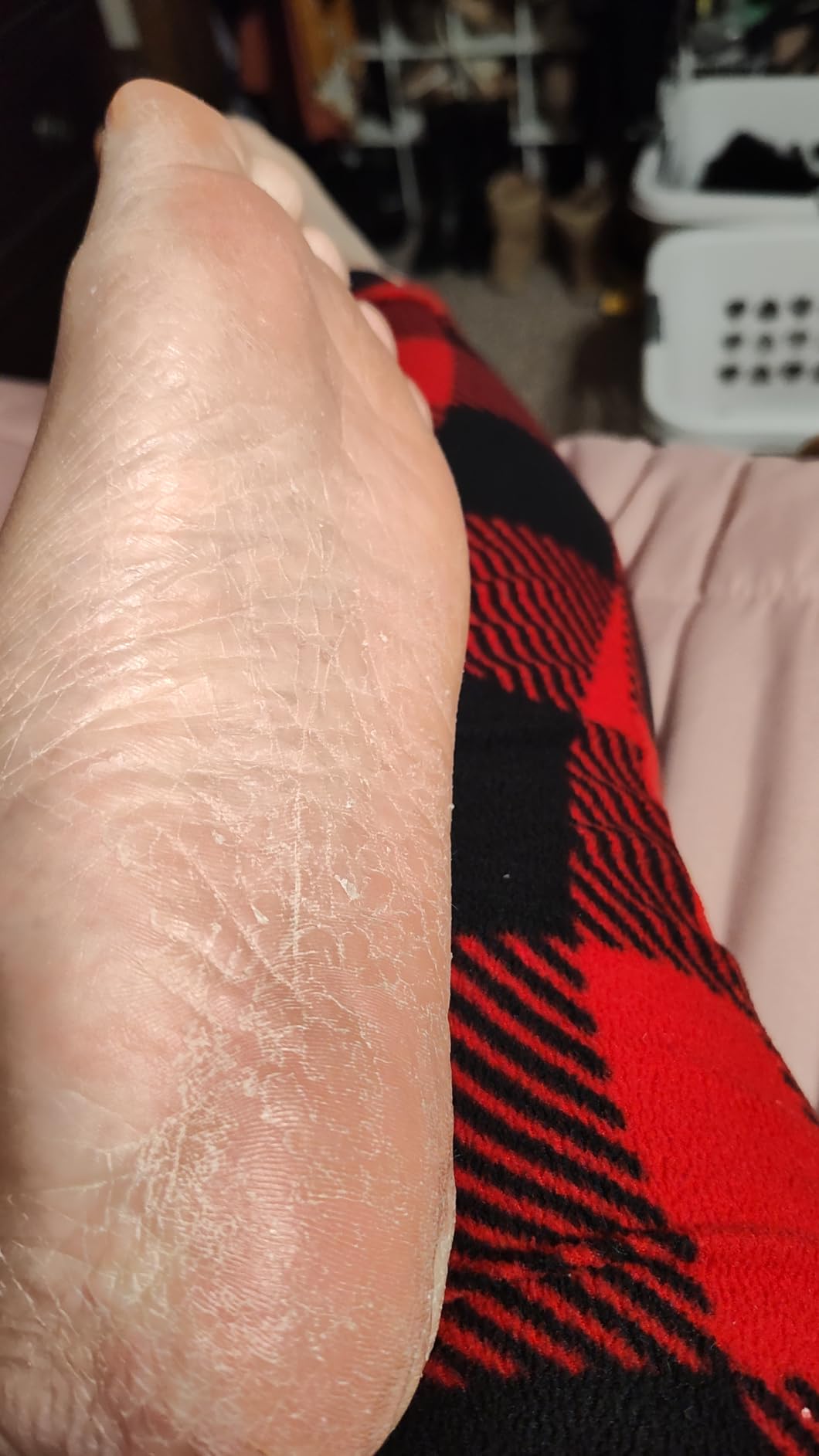 CÉLOR Foot Peeling Mask for Dry Cracked Feet | Foot Mask to Exfoliate Rough, Cracked, Dry Feet, Calluses for Soft Baby Feet Results | Made with Aloe Vera Extract for Women & Men (2 Pairs) | Lavender