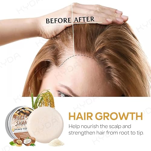 Miniatura 2 de KYDA 3 barras de champú de agua de arroz para el crecimiento del cabello, cobertura blanca de raíz, oscurecimiento del cabello, voluminización y