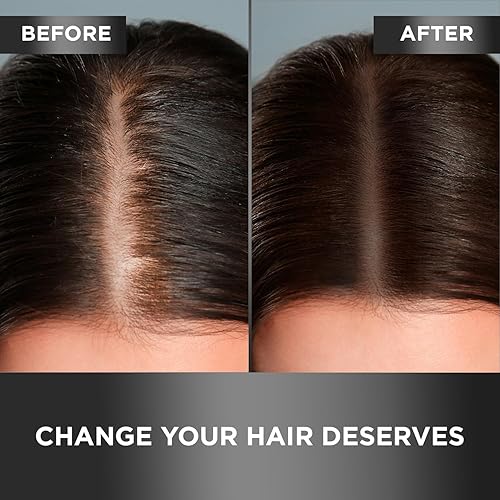 Miniatura 4 de Moehair Trio Pack de champú Hair Guard 34 FL  acondicionador protector para el cabello 34 FL y suero para el cabello 05 FL  Juego de cuidado y