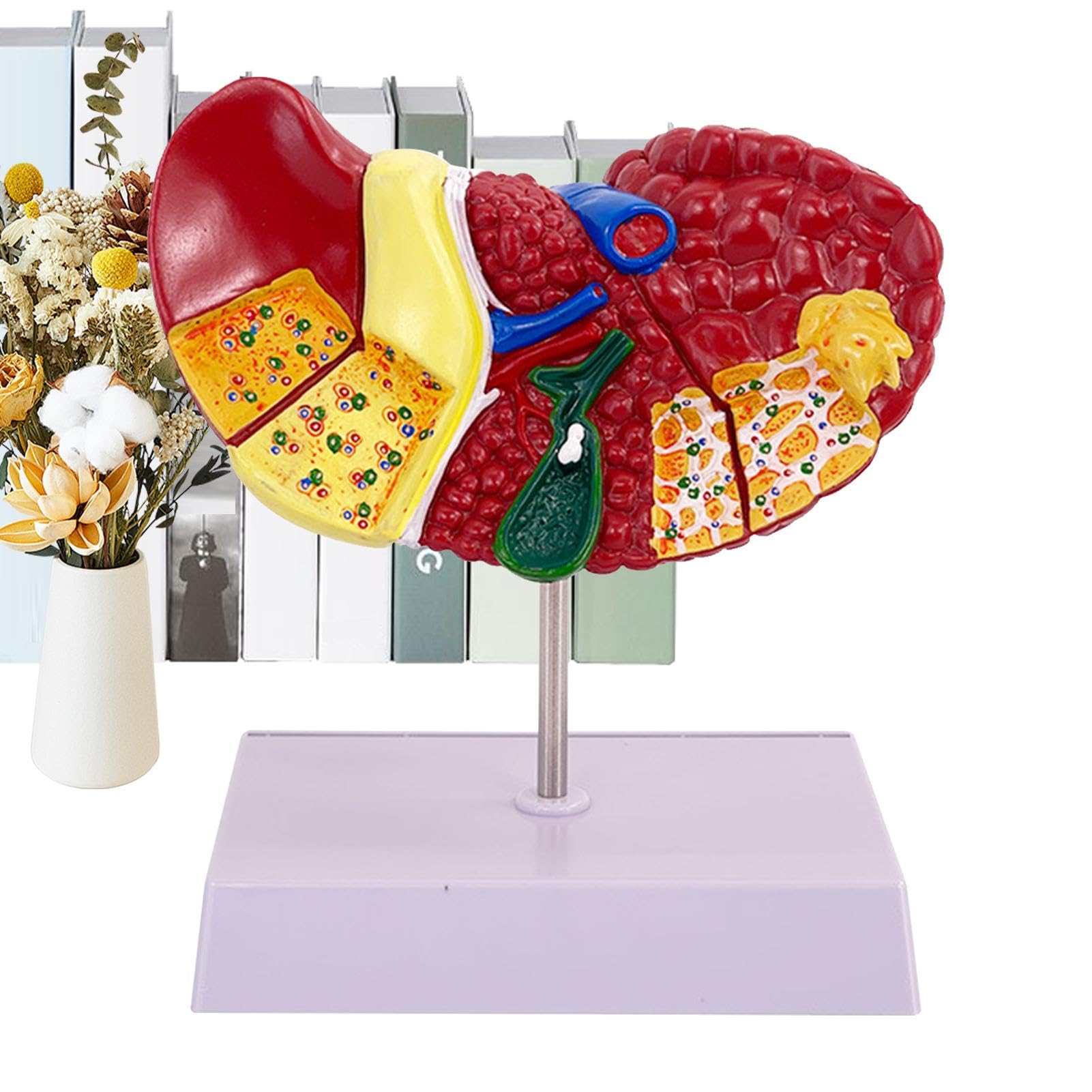 Human Liver Anatomy Model,Anatomical Pathology Model with Clear Texture for Display - Liver Teaching Model, Versatile Display Liver Model for Model School Human Liver Display, Hospitals