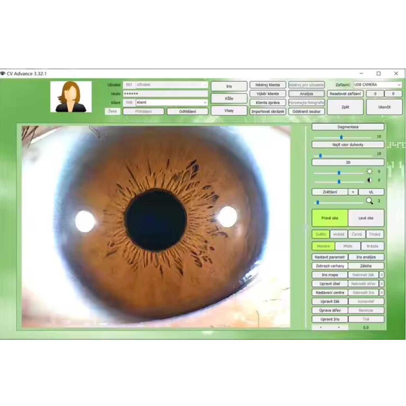 5.0 MP USB Iridology Camera Analyzer, Iris Analysis Camera, High Resolution Ccd USB Iriscope Eye Iridology Camera, HD 30x Iris Lens Analysis English Pro Iris Software