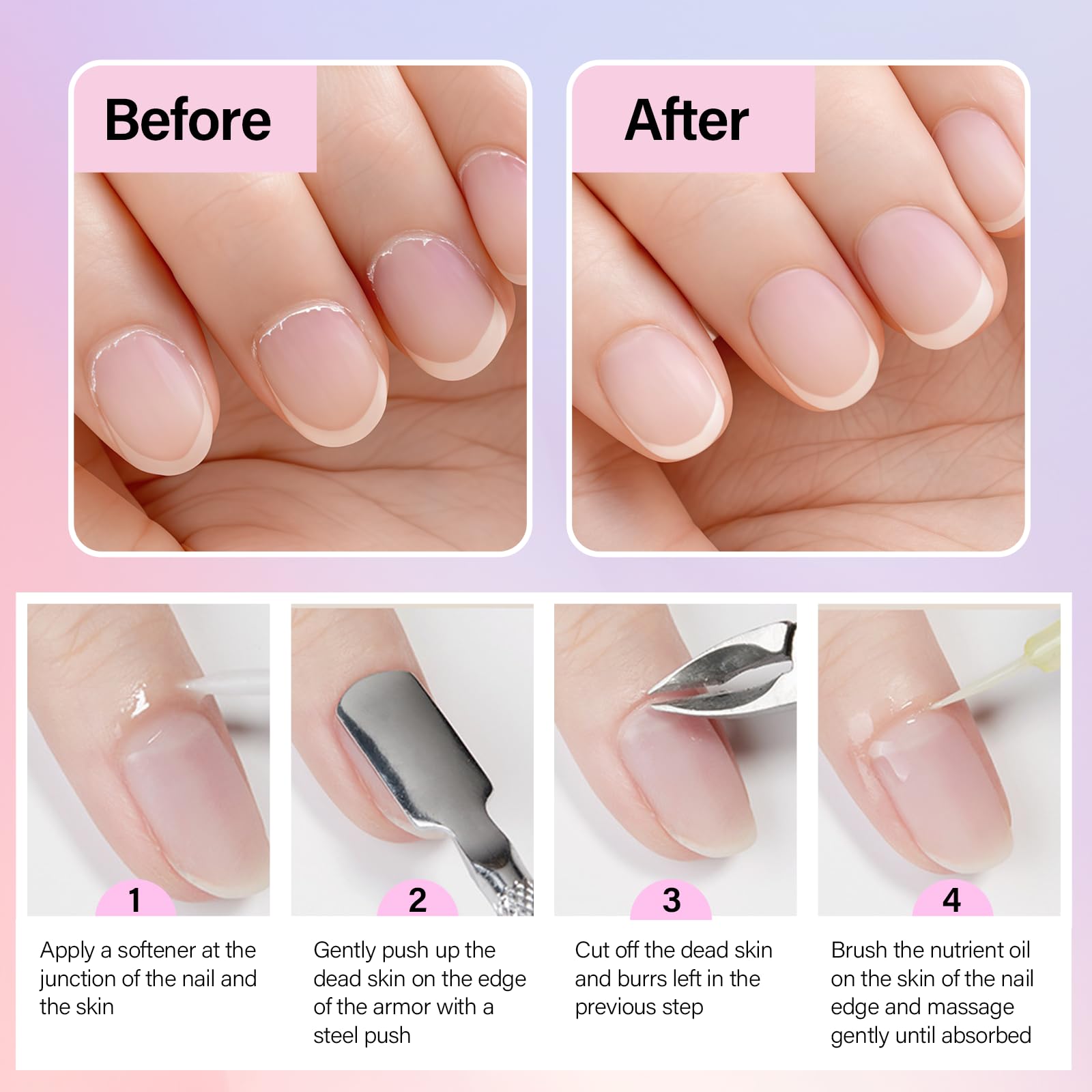3-teiliges Nagelhautzangen Set, Professionelle Edelstahl Nagelhautzange mit Nagelknipser und Nagelhautschieber, Entfernung Überschüssige Eingerissener Haut,für Fußnägel und Fingernägel