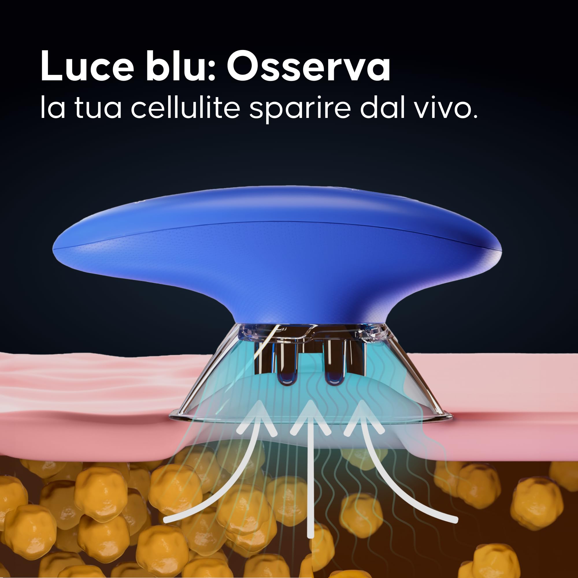 Massaggiatore anticellulite con ventosa elettrica Cellublue - Riduce la cellulite - Risultati visibili in 7 giorni - Palpato-rotolato, 6 livelli regolabili di intensità - Trattamento professionale a
