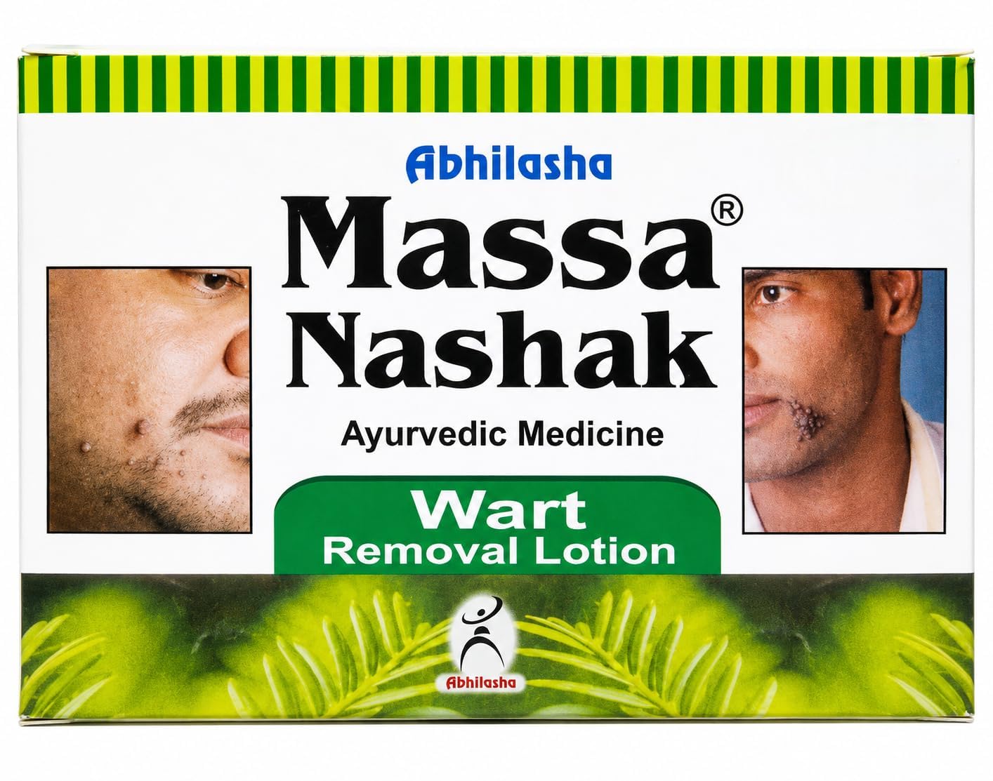 Massa Nashak | Wart removal lotion | Ayurvedic wart removal lotion| No Side effects | Fast Acting., Pack of 2-image-32