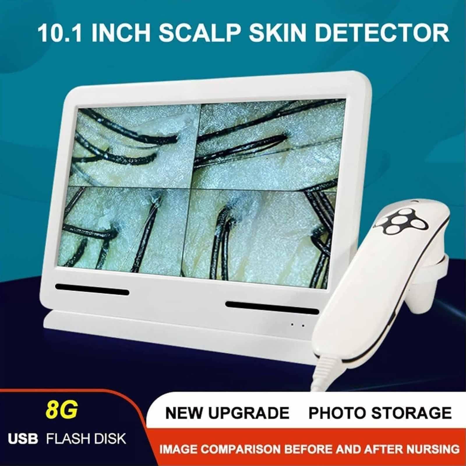 Haut Haar Analysegerät, 10,1 Zoll HD LCD Bildschirm, Mit Vier Rastern/Speicherfunktion 50X/200X Hautvergrößerung, Professionelles Follikelanalysegerät für Zuhause & Salon