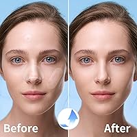 Vista 4 de Parches grandes para espinillas para cara, parches de acné hidrocoloide, vendajes hidrocoloides grandes, cubiertas de granos de formas variadas