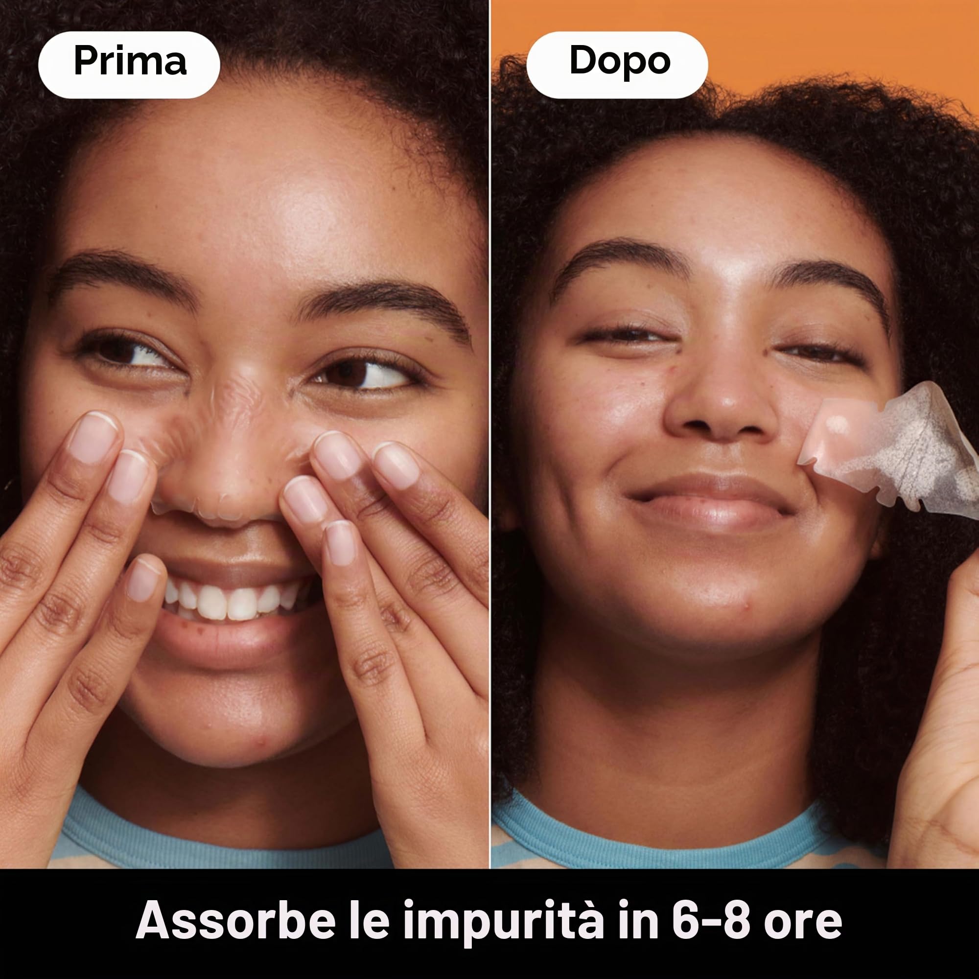 Hero Mighty Patch Nose: Cerotto anti-acne all'idrocolloide che assorbe le impurità dai pori e dai brufoli sul naso in 6 ore, confezione da 10 cerotti.