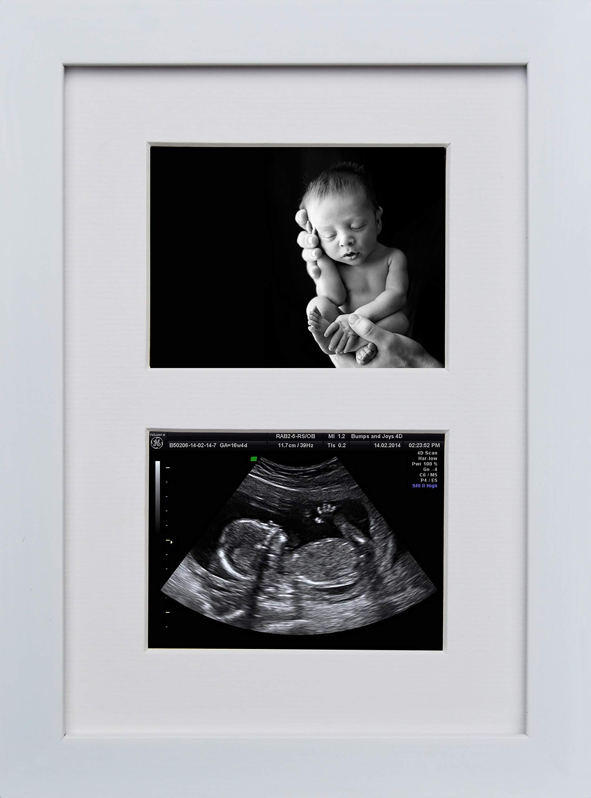 Hand Made Double Aperture White Gloss Ultrasound Photo Sonogram Baby Scan Picture Frame