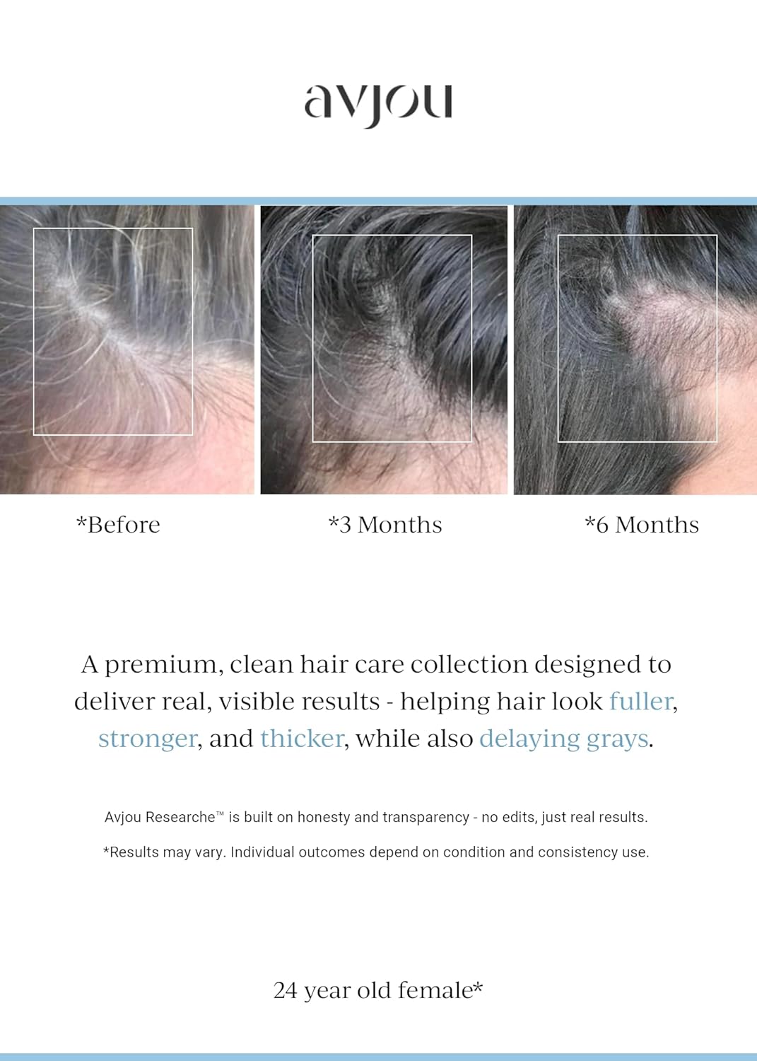 Avjou Researche™ Scalp Serum – Thicker, Fuller-Looking Hair + Targets Visible Signs of Premature Greying – 3 Patented Ingredients – Backed by Cosmetic Science – Oil-Free, All Hair Types, 1.7 oz