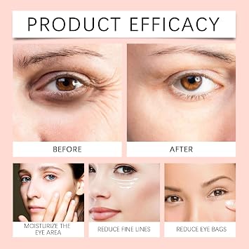 Madagascar Centella Probio-Cica Bakuchiol Eye Cream, Wrinkle Repair Eye Cream for Dark Circles, Instant Temporary Eye Firmer, Tightens and Smooths the Appearance of Fine Lines